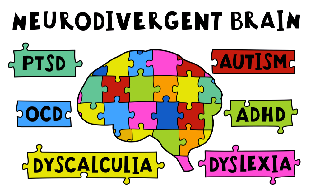 Illustration of a neurodivergent brain representing inclusive remedial support at Max Academy